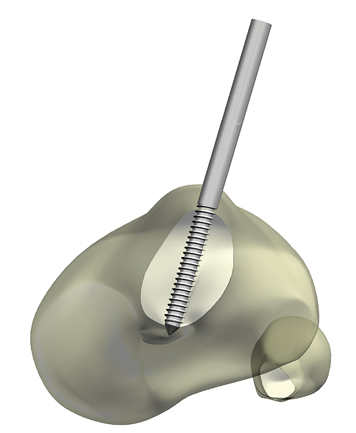 stable frame figure 12b