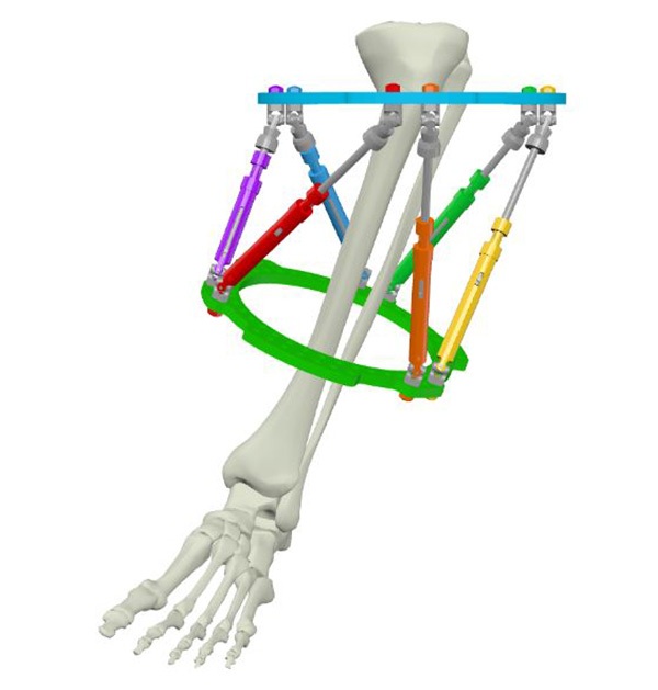 Figure 1a