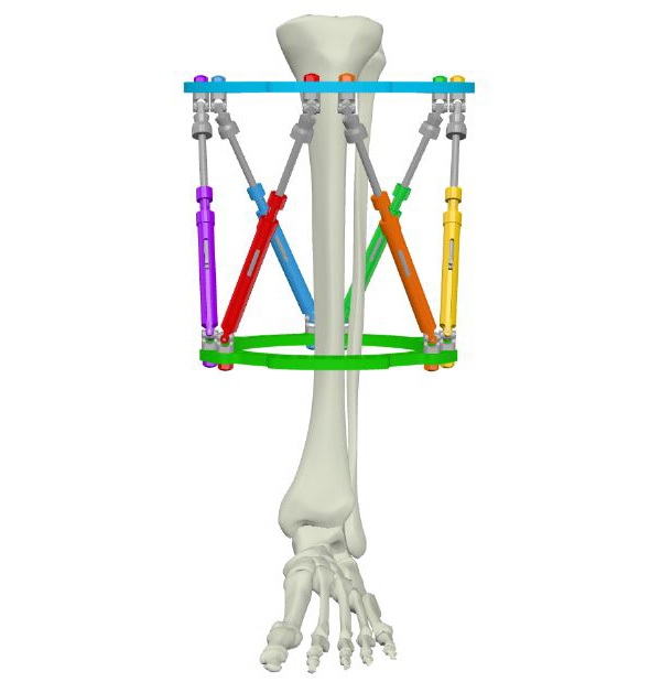 Figure 1b