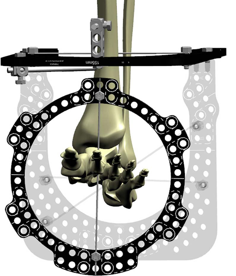 configuring butt frame figure 3a