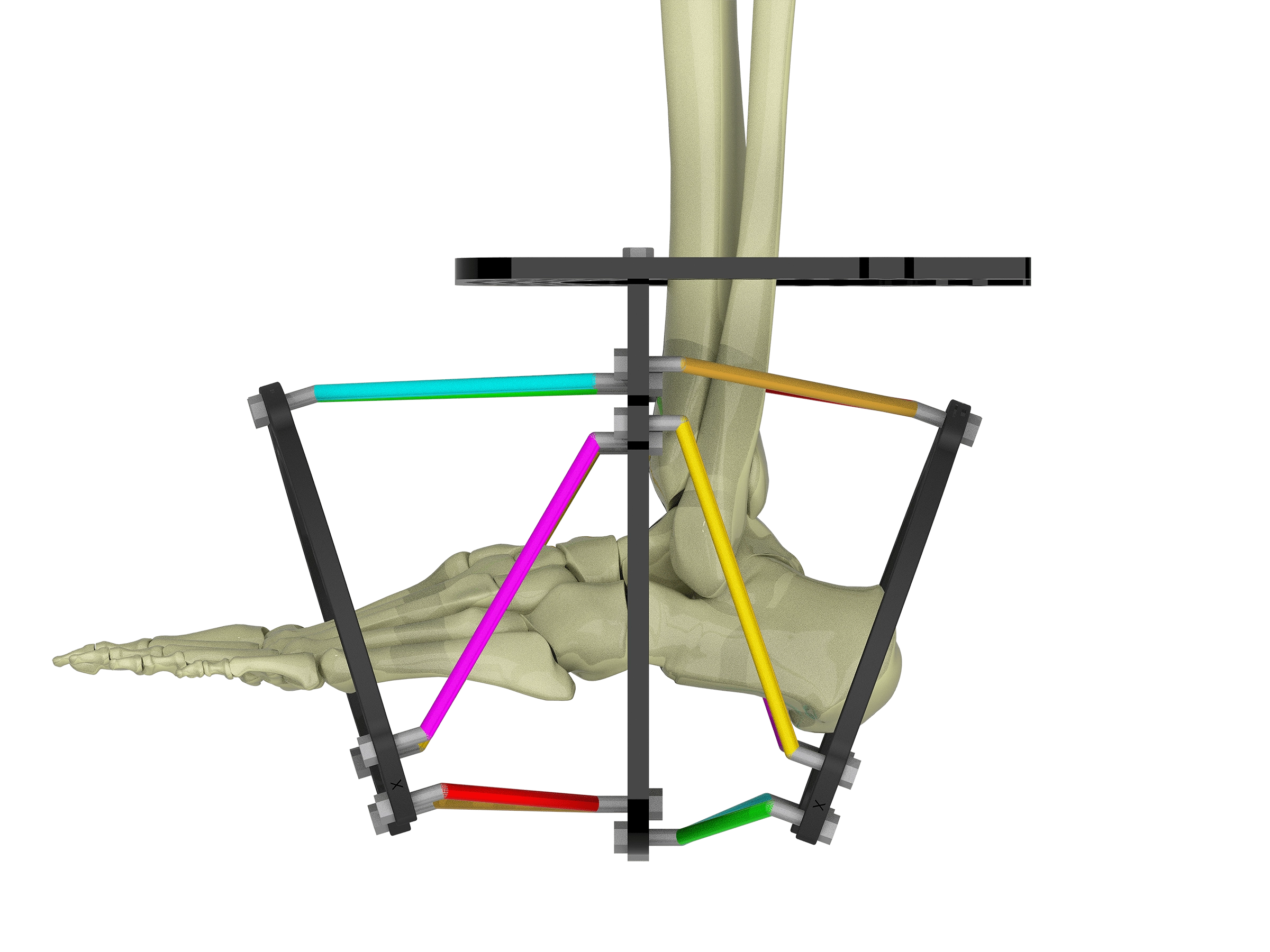 configuring butt frame