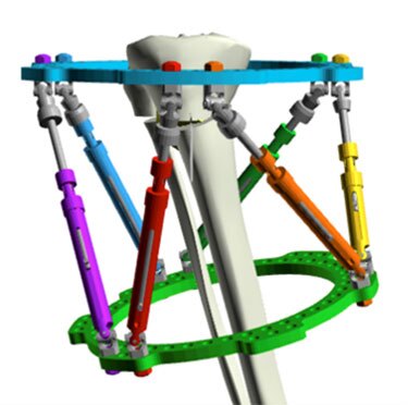 hypertrophic nonunions figure 4a