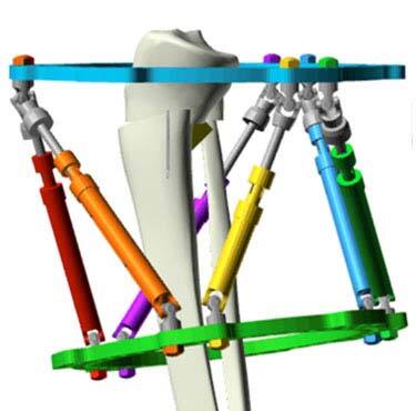 hypertrophic nonunions figure 4b