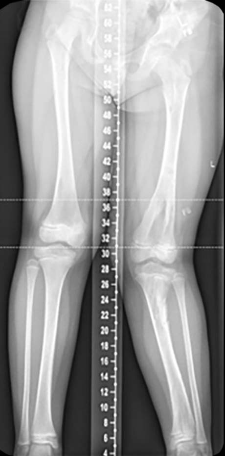paediatric deformity figure 1