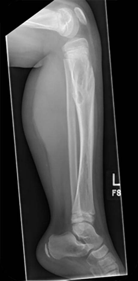 paediatric deformity figure 2