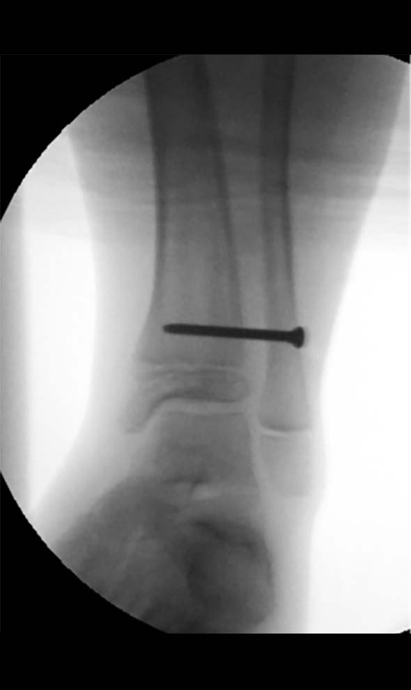 paediatric deformity figure 3