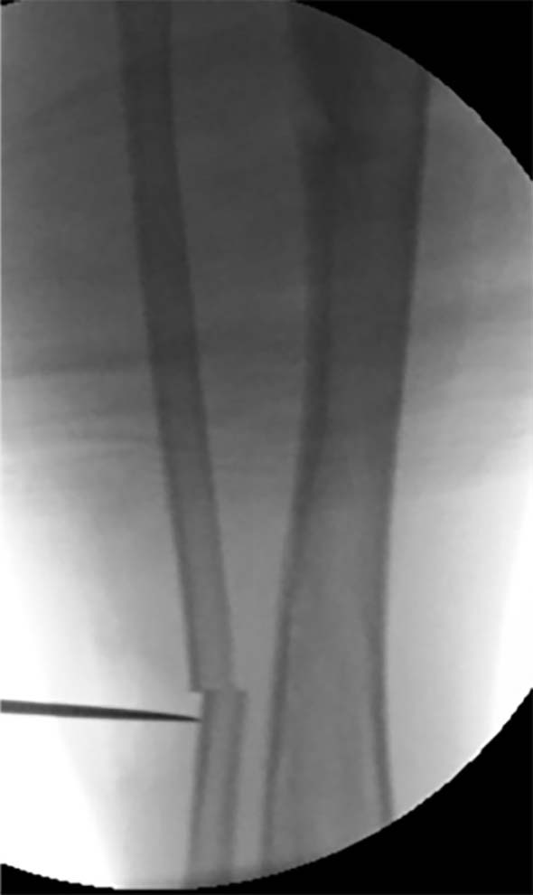 paediatric deformity figure 4