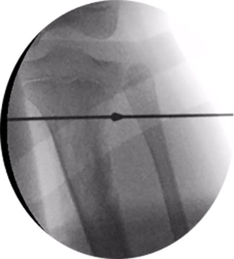 paediatric deformity figure 5