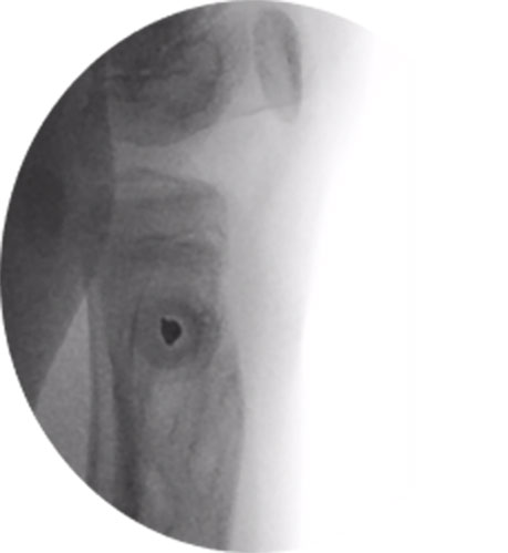 paediatric deformity figure 6
