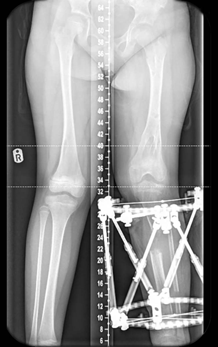 paediatric deformity figure 9