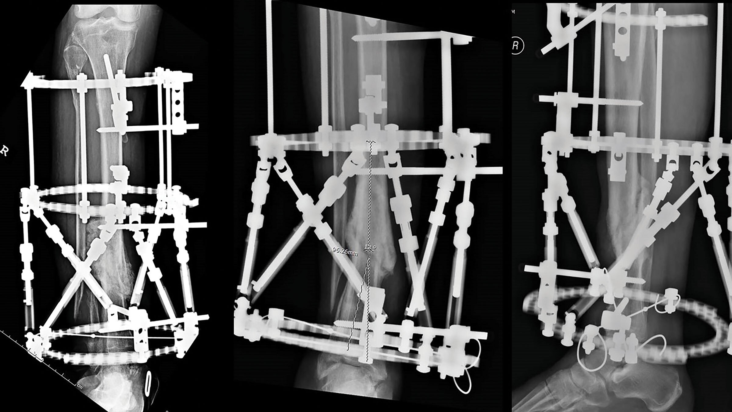 Figure 6 stable frame figure 6