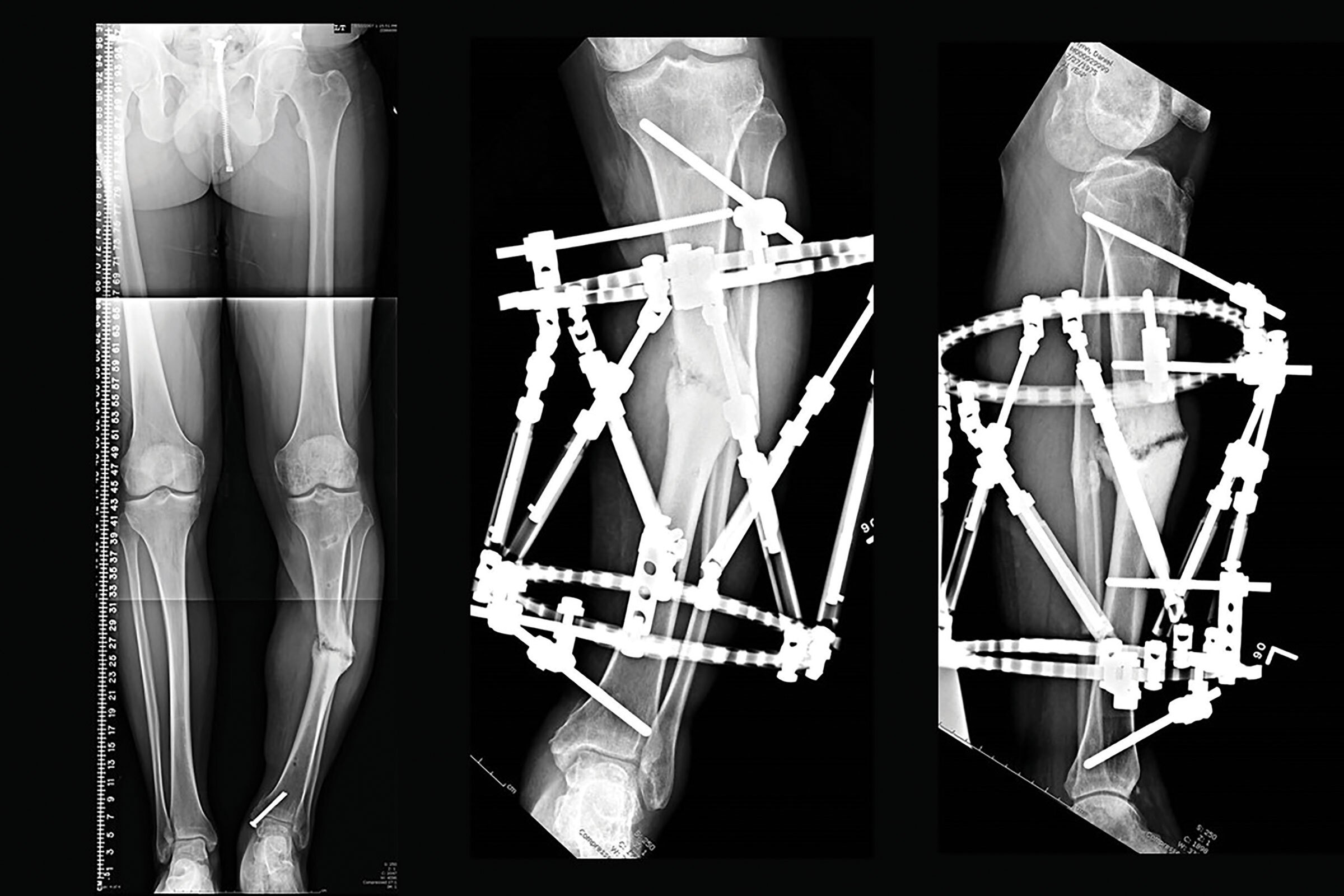 stable frame figure 9