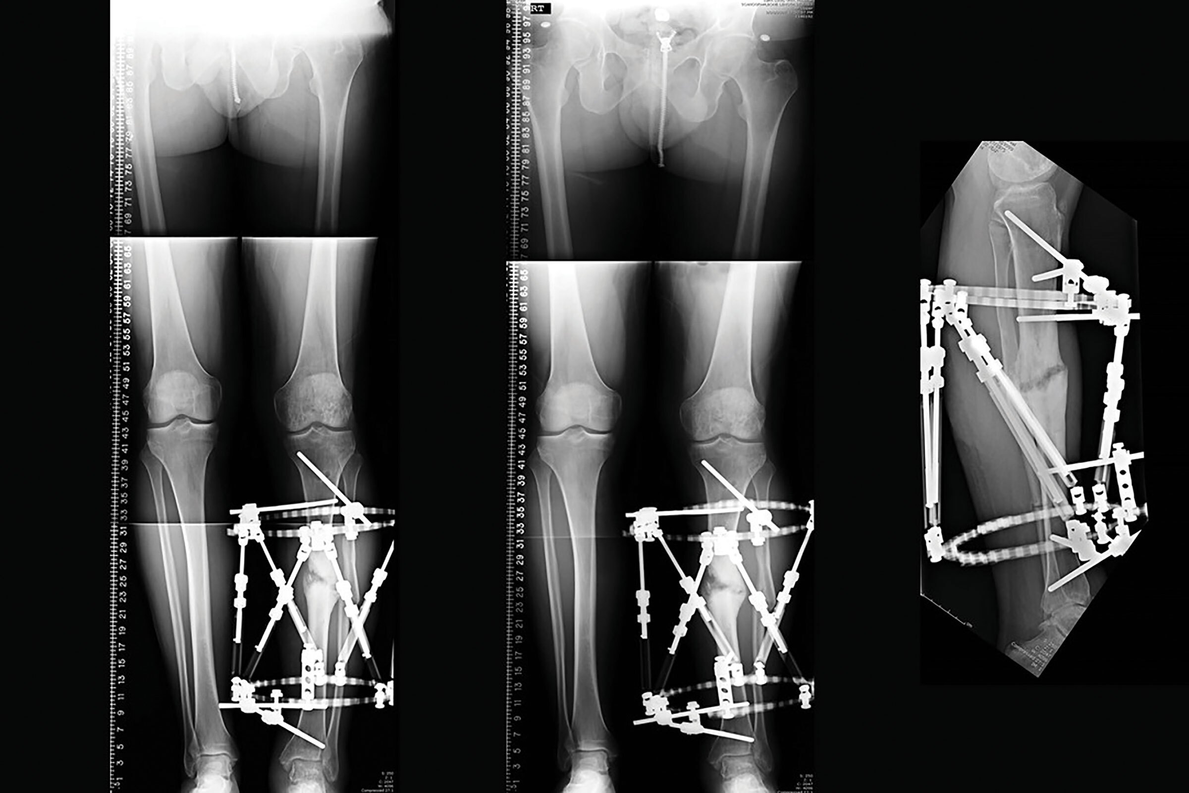stable frame figure 9