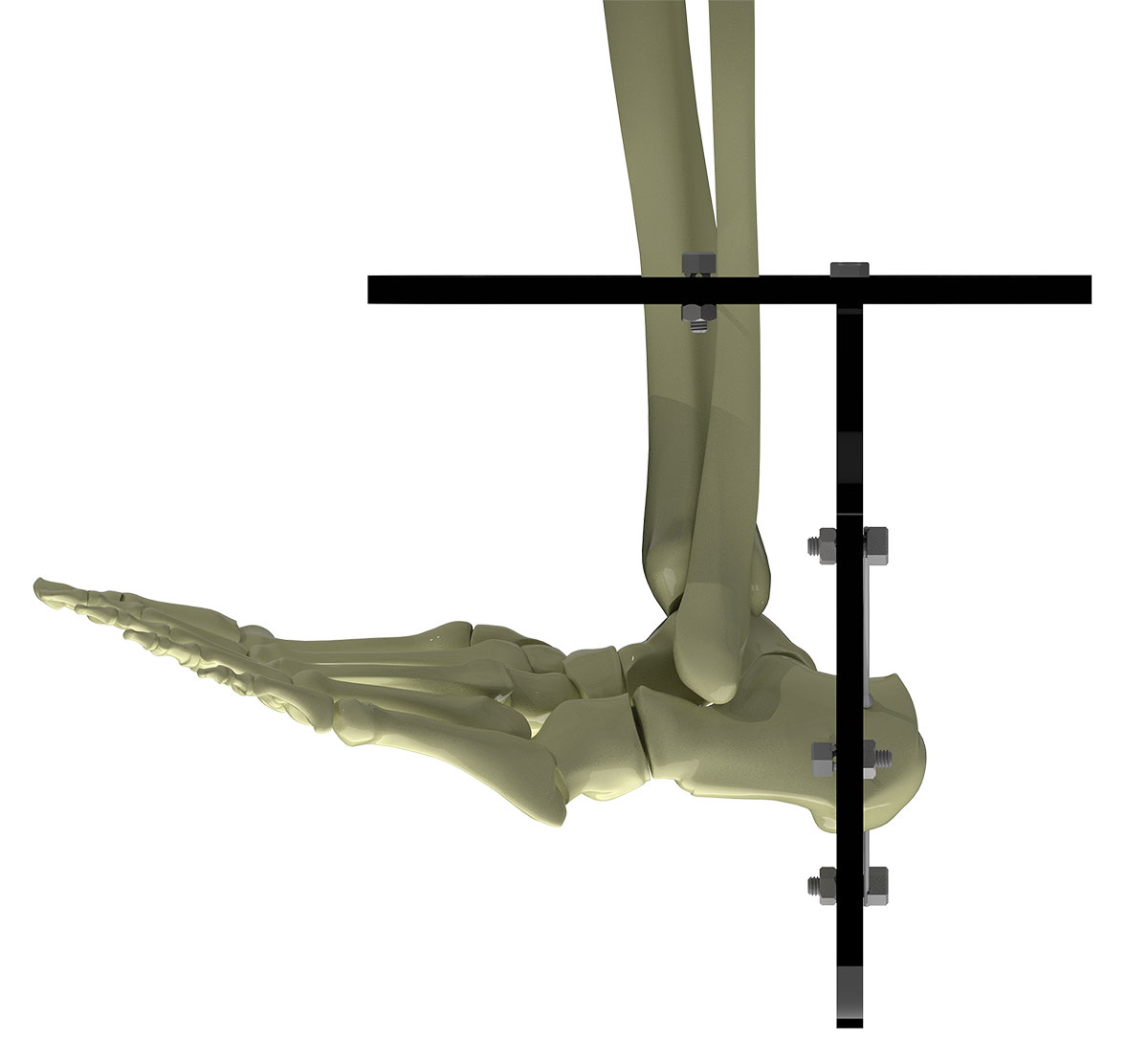 configuring butt frame figure 2b