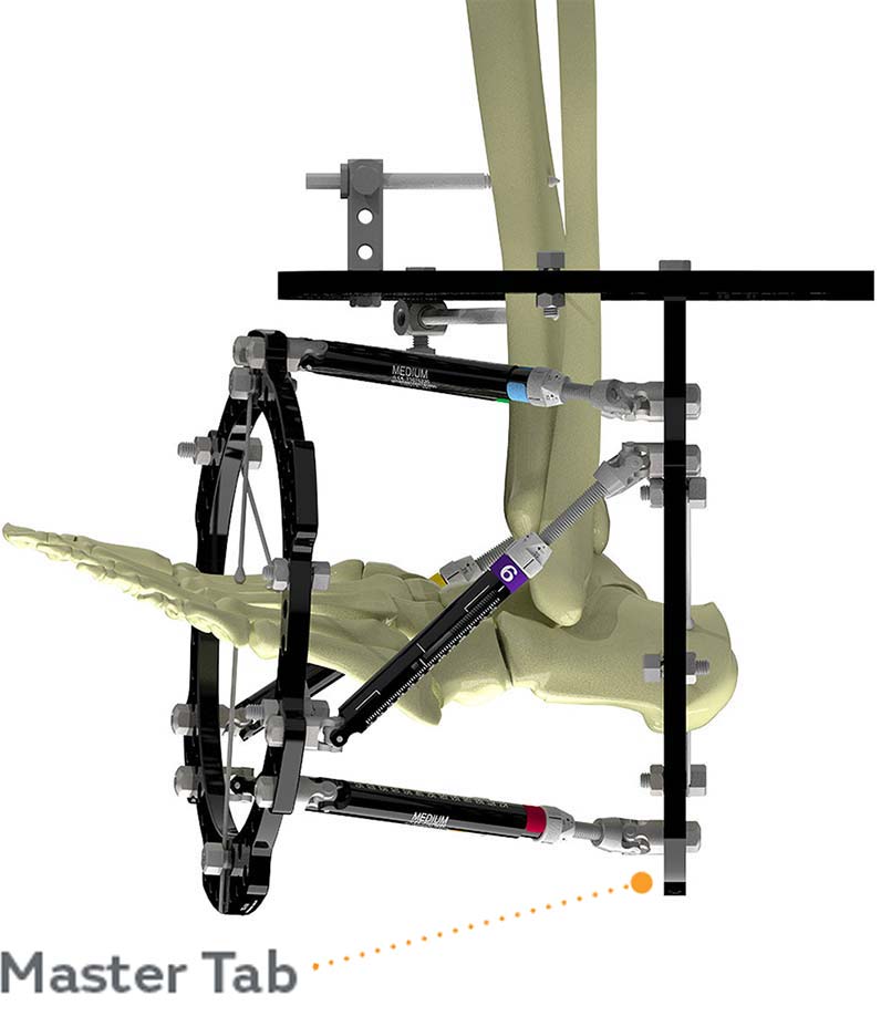 configuring butt frame figure 3d