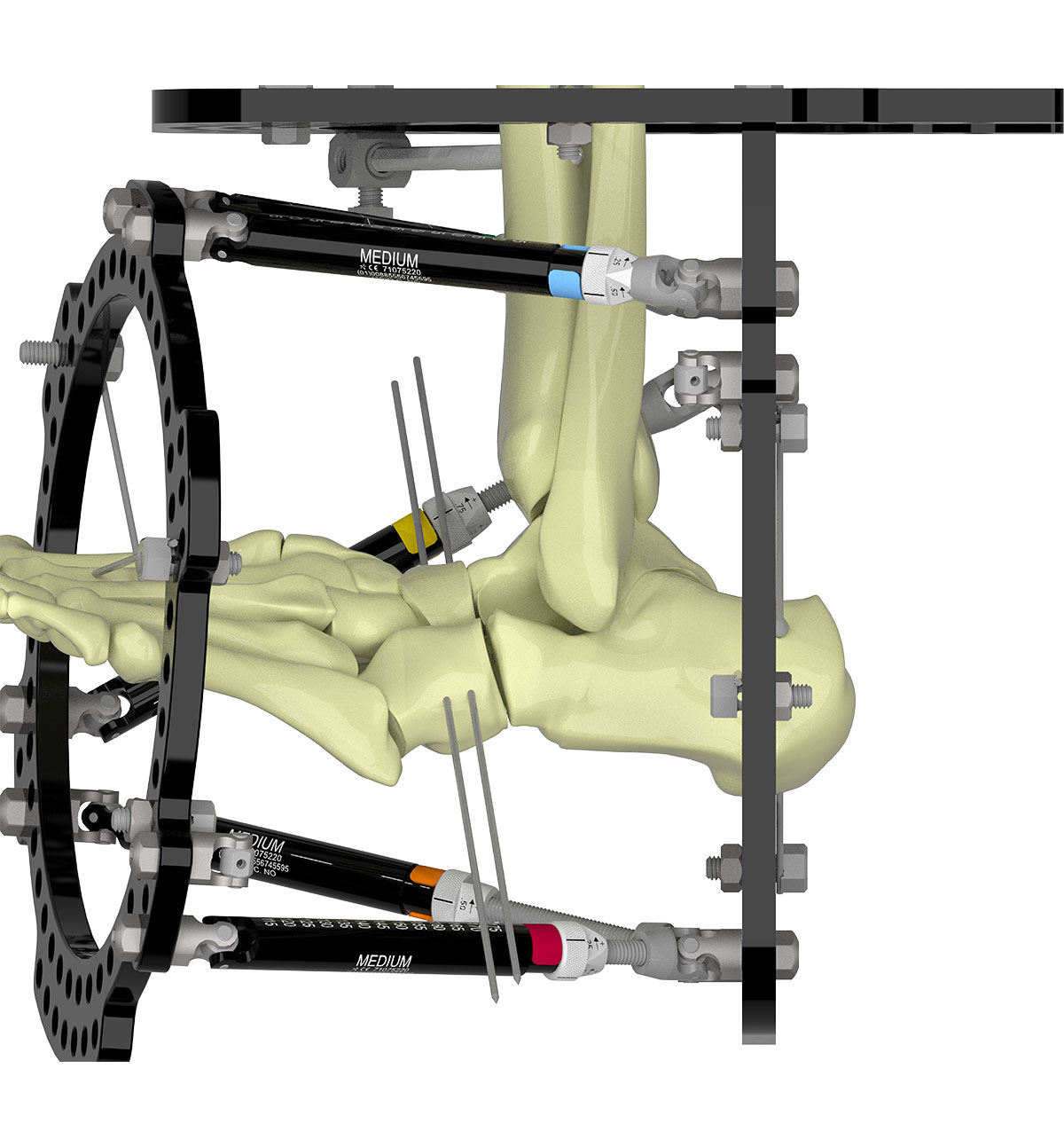 configuring butt frame figure 4a