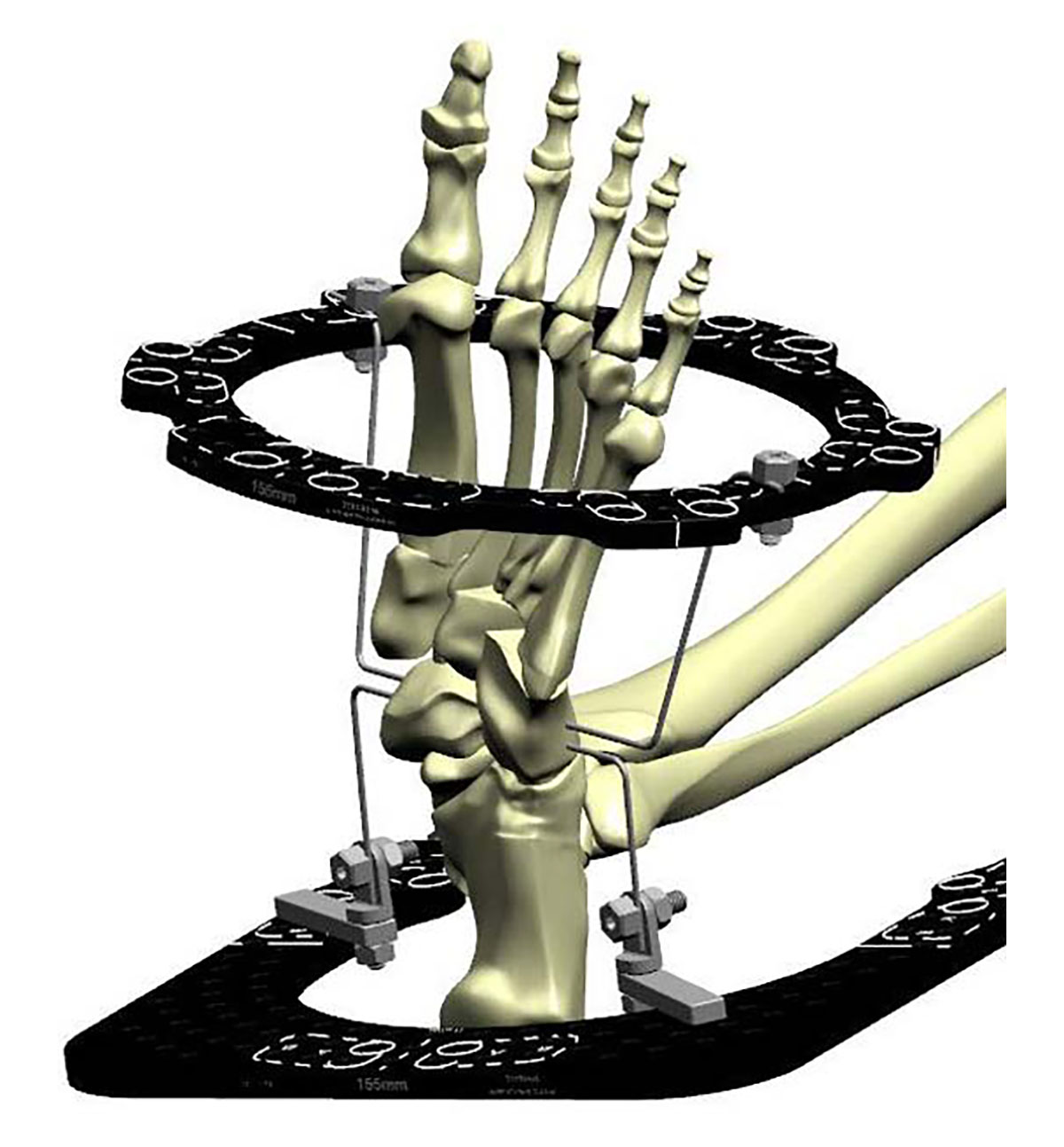 configuring butt frame figure 4b