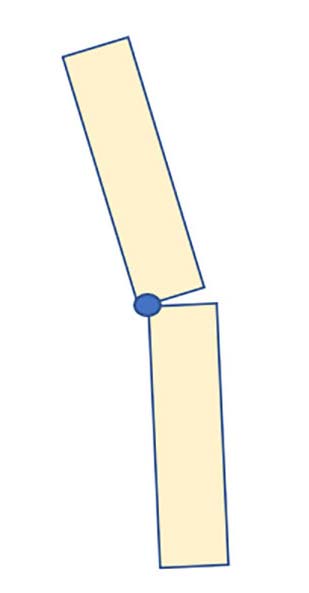 deformity reduction figure 2b