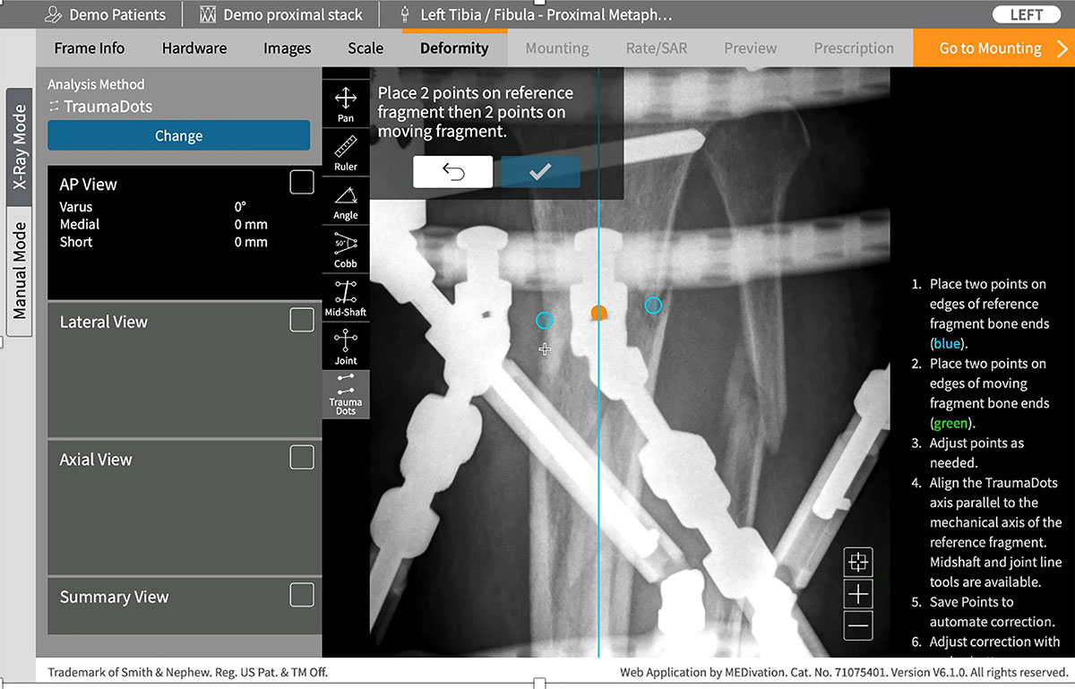 deformity reduction figure 5b