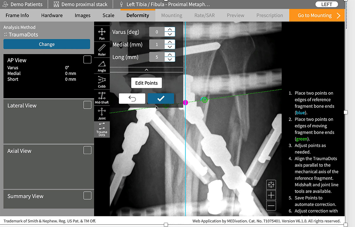 deformity reduction figure 5d