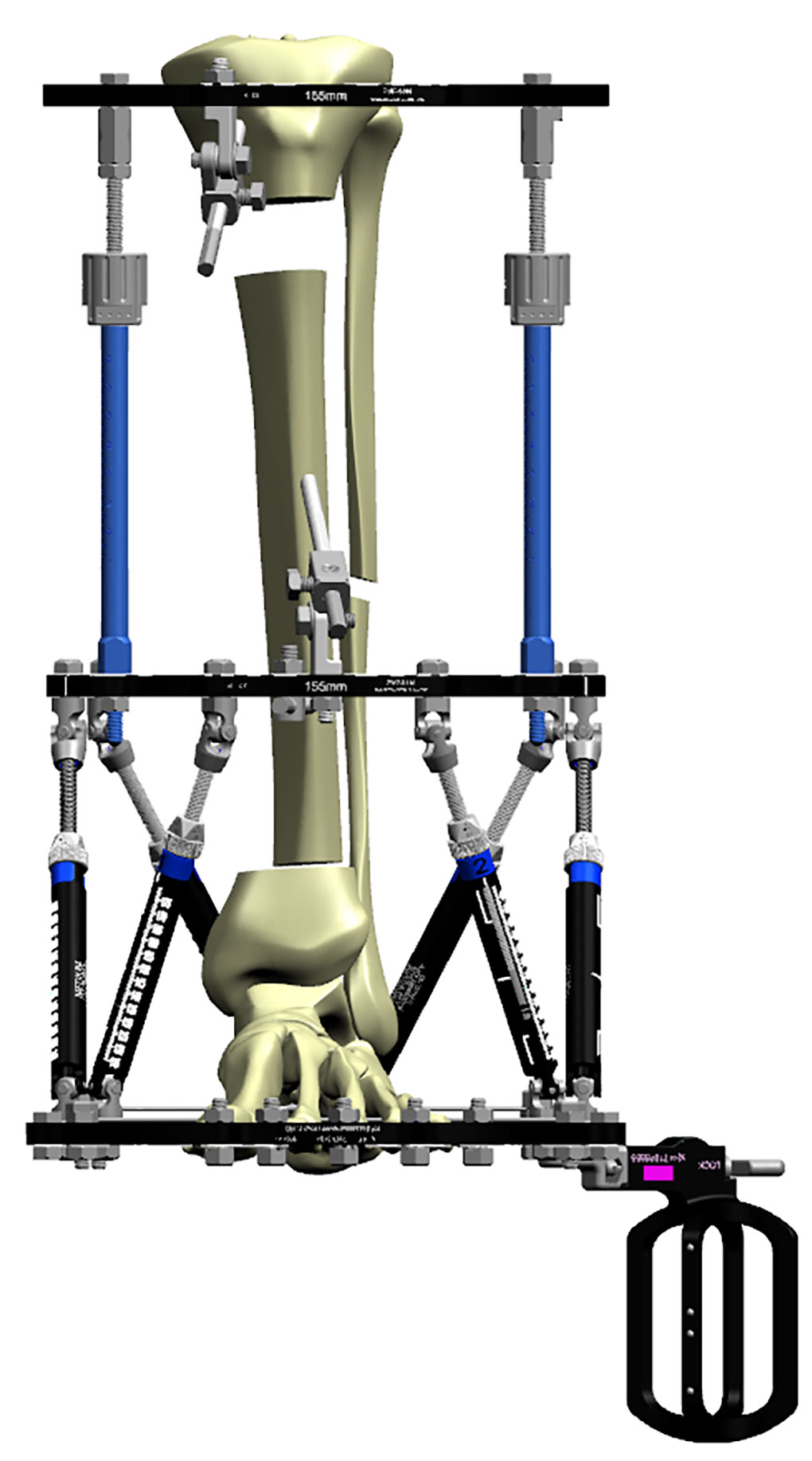 frame construction