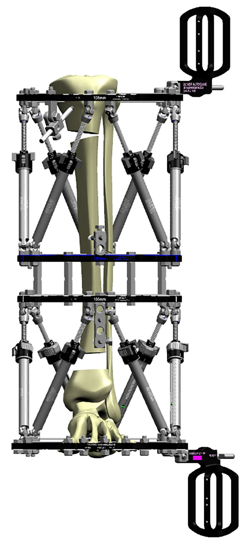 frame construction