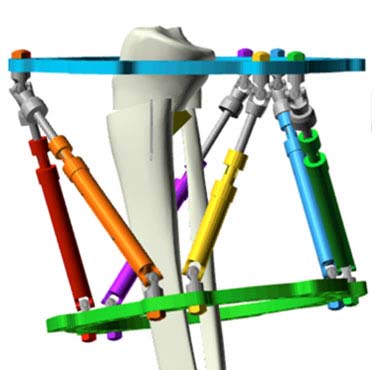 hypertrophic nonunions figure 4b