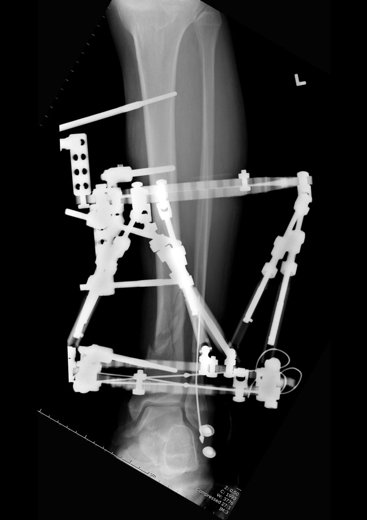 stable frame figure 10a