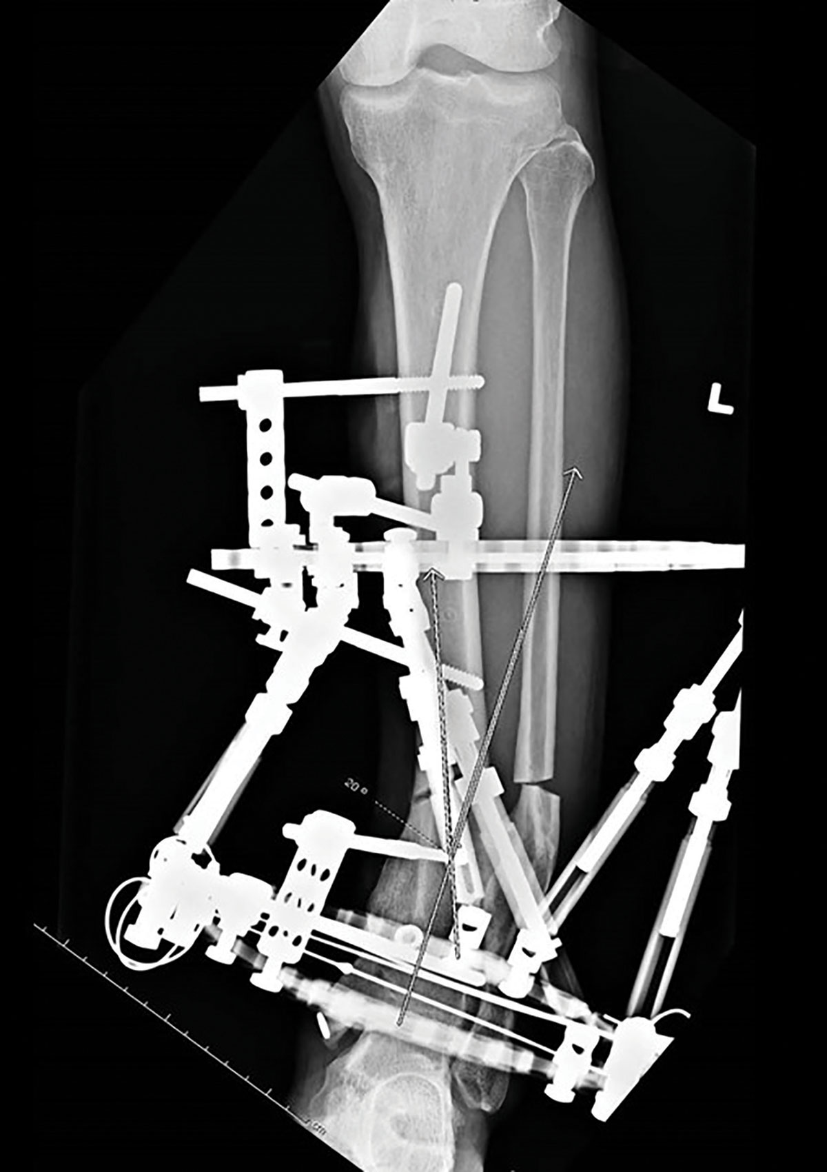 stable frame figure 10b