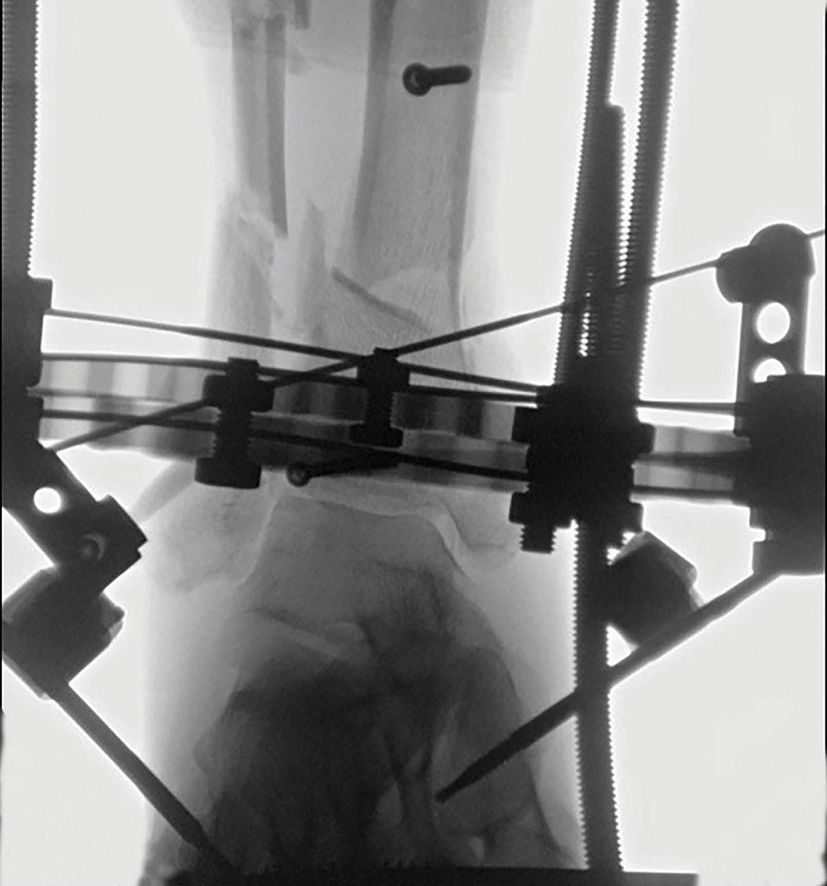 stable frame figure 10c