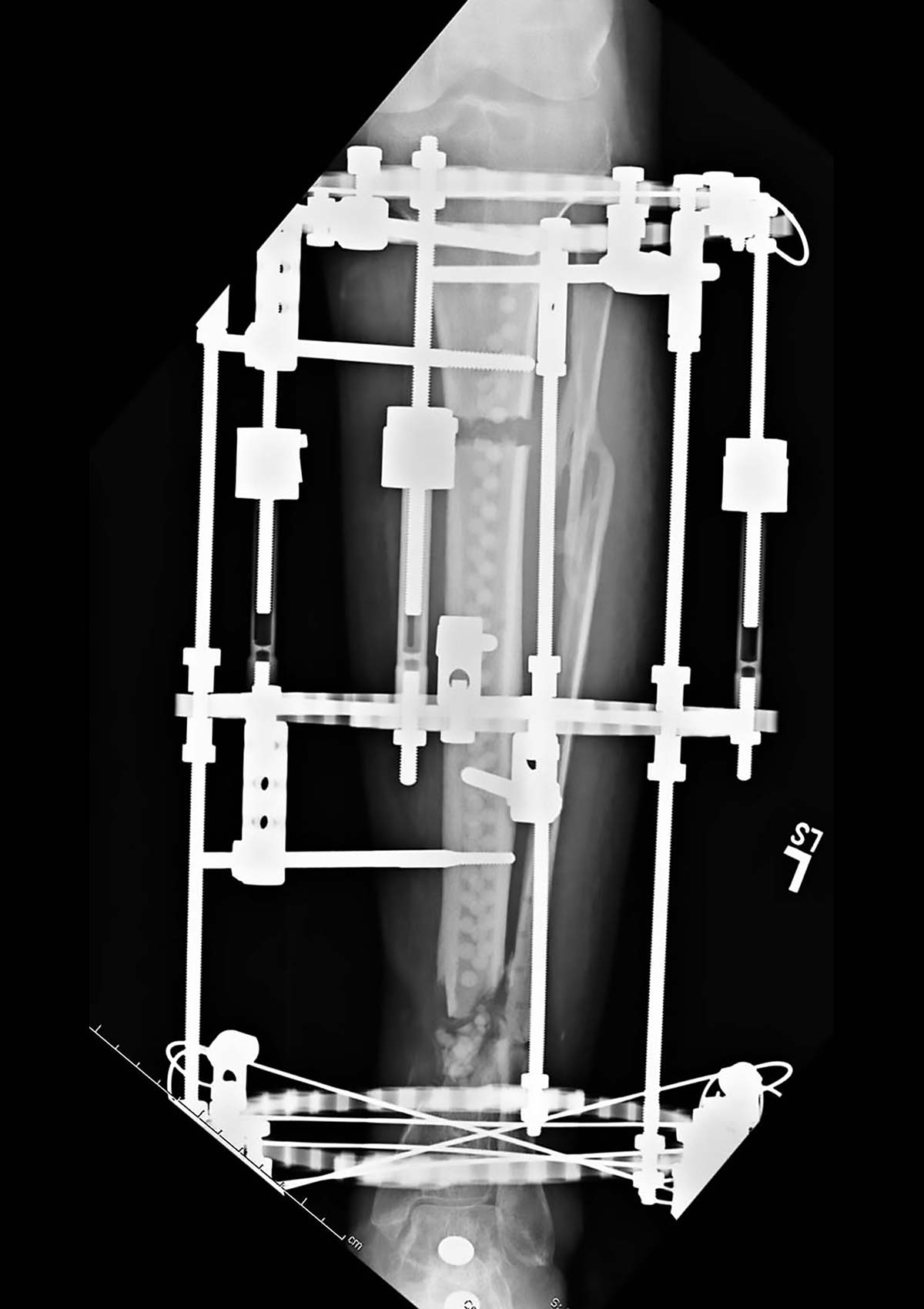 stable frame figure 11
