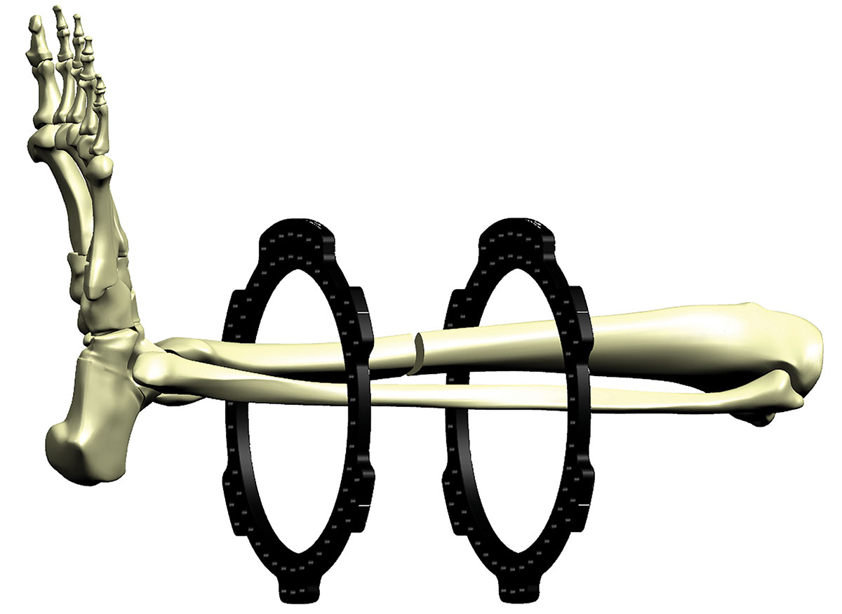 stable frame figure 12a
