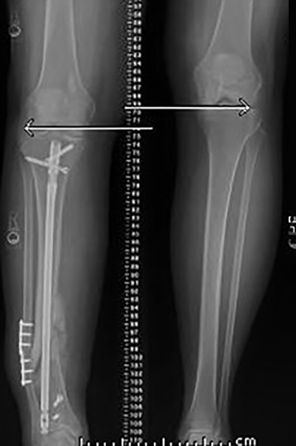 stable frame figure 1a