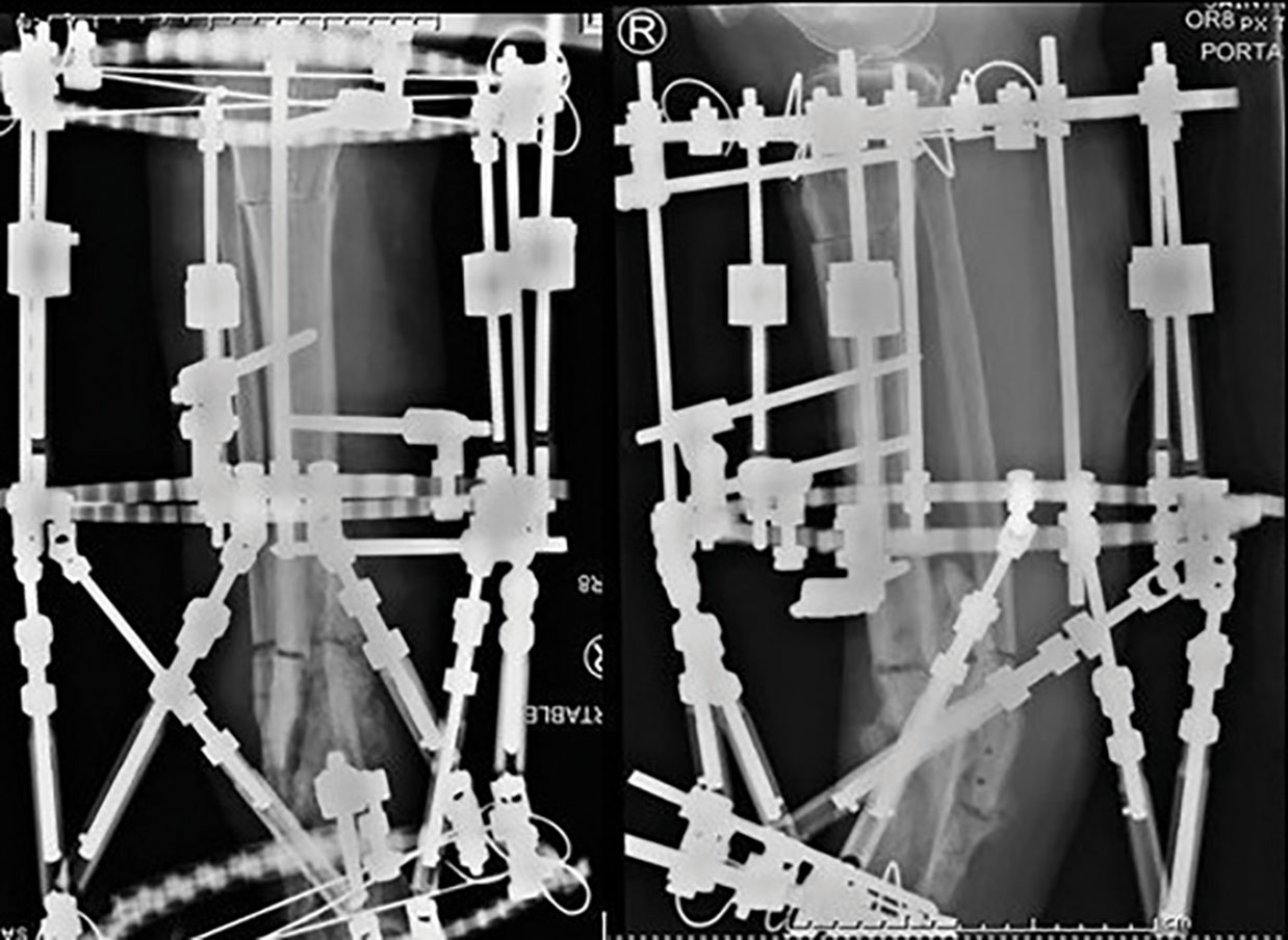 stable frame figure 1c