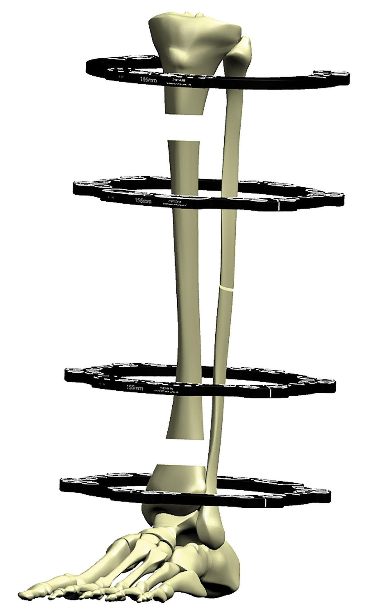 stable frame figure 2b