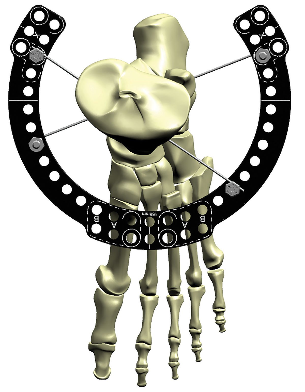 stable frame figure 3b