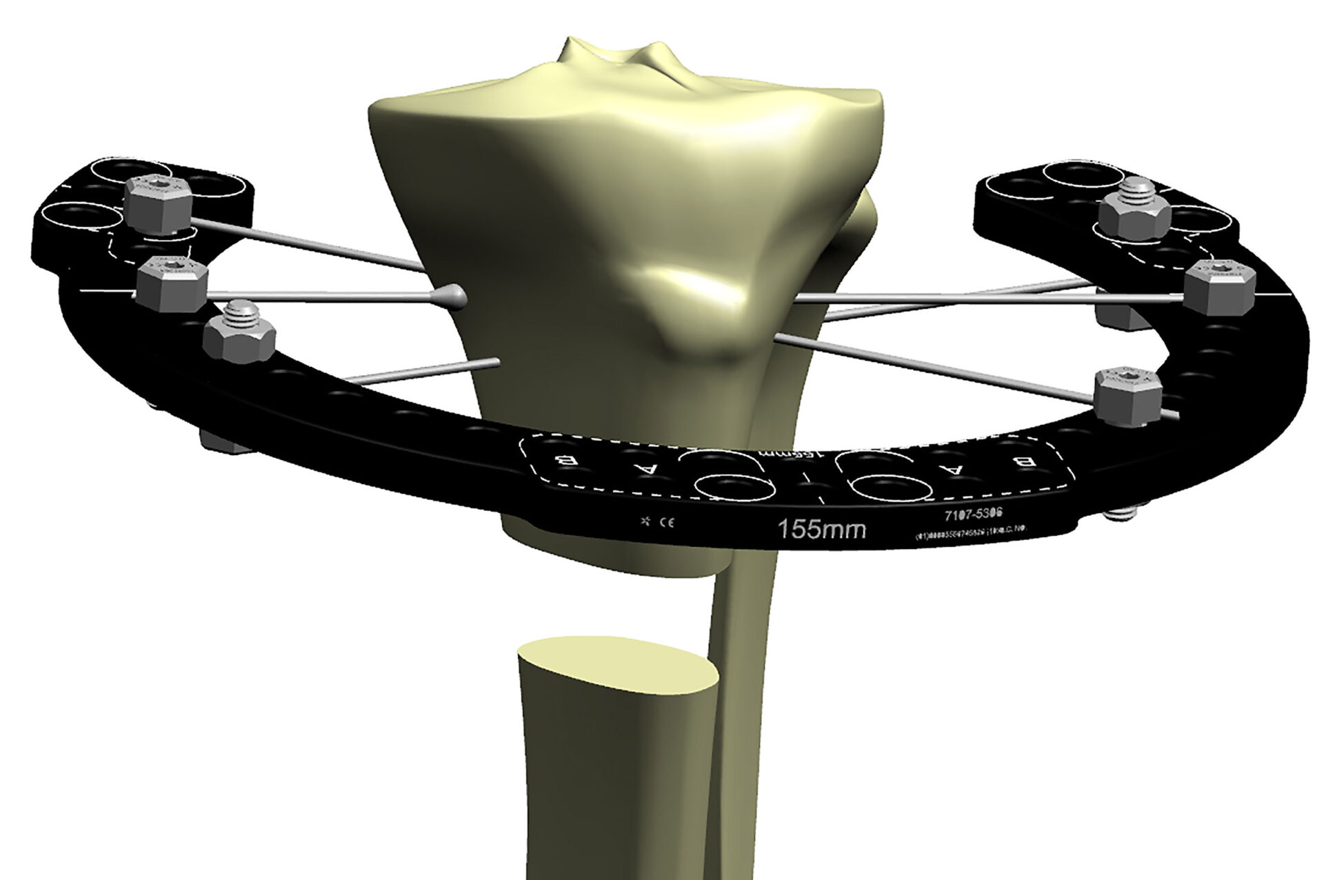 Constructing a Stable Frame - Compendium of TSF Applications