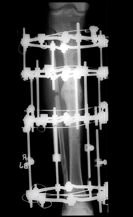 stable frame figure 4d