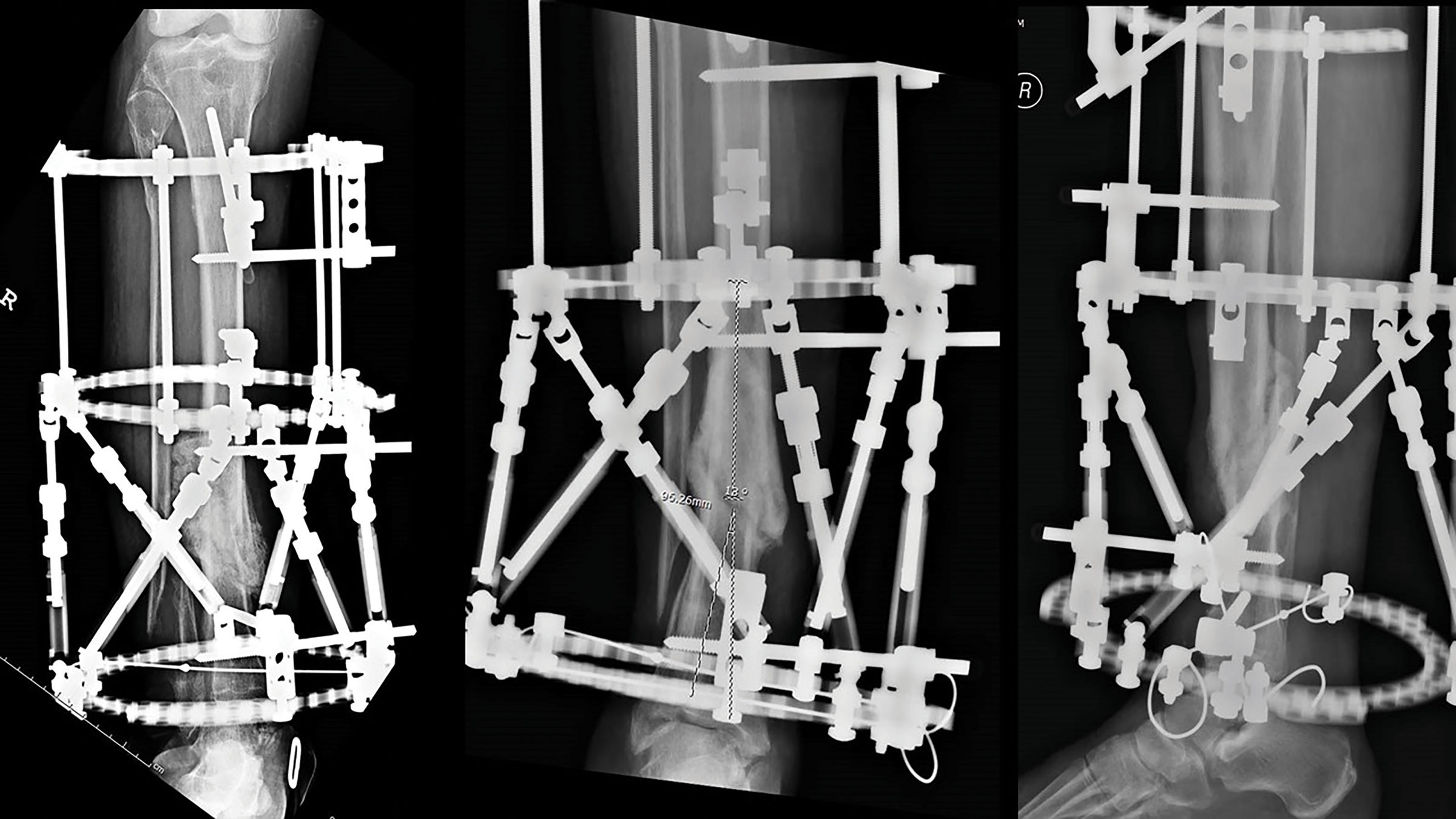 Figure 6 stable frame figure 6