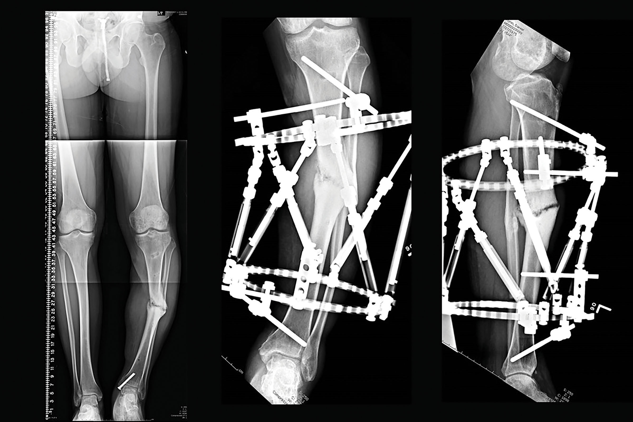 stable frame figure 9