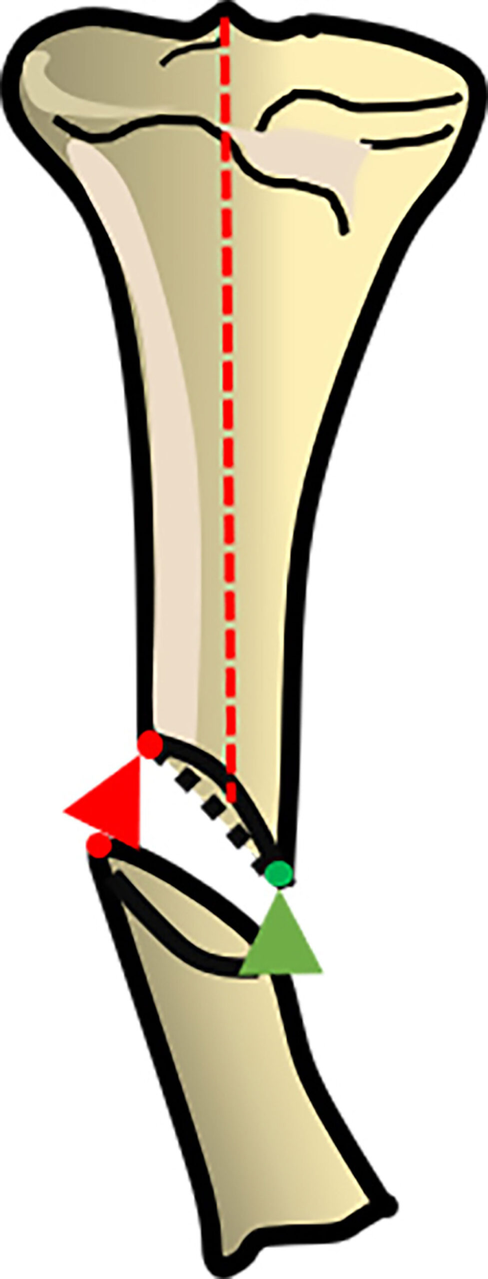 trauma techniques figure 10a