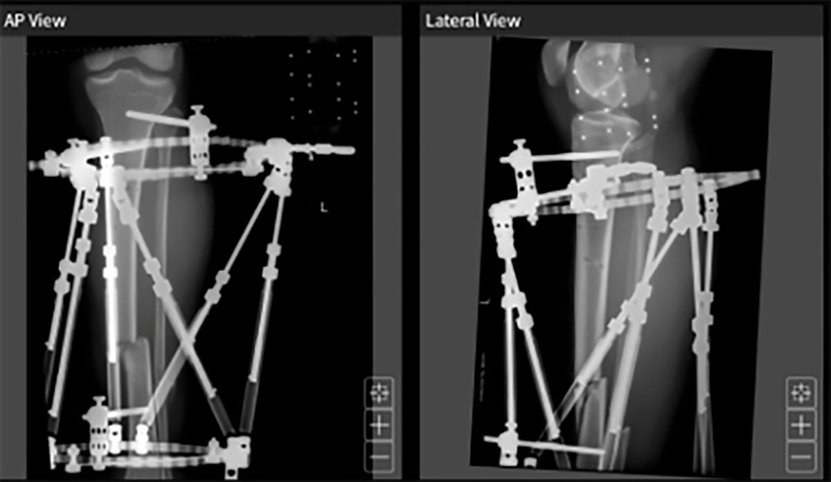 trauma techniques figure 10b