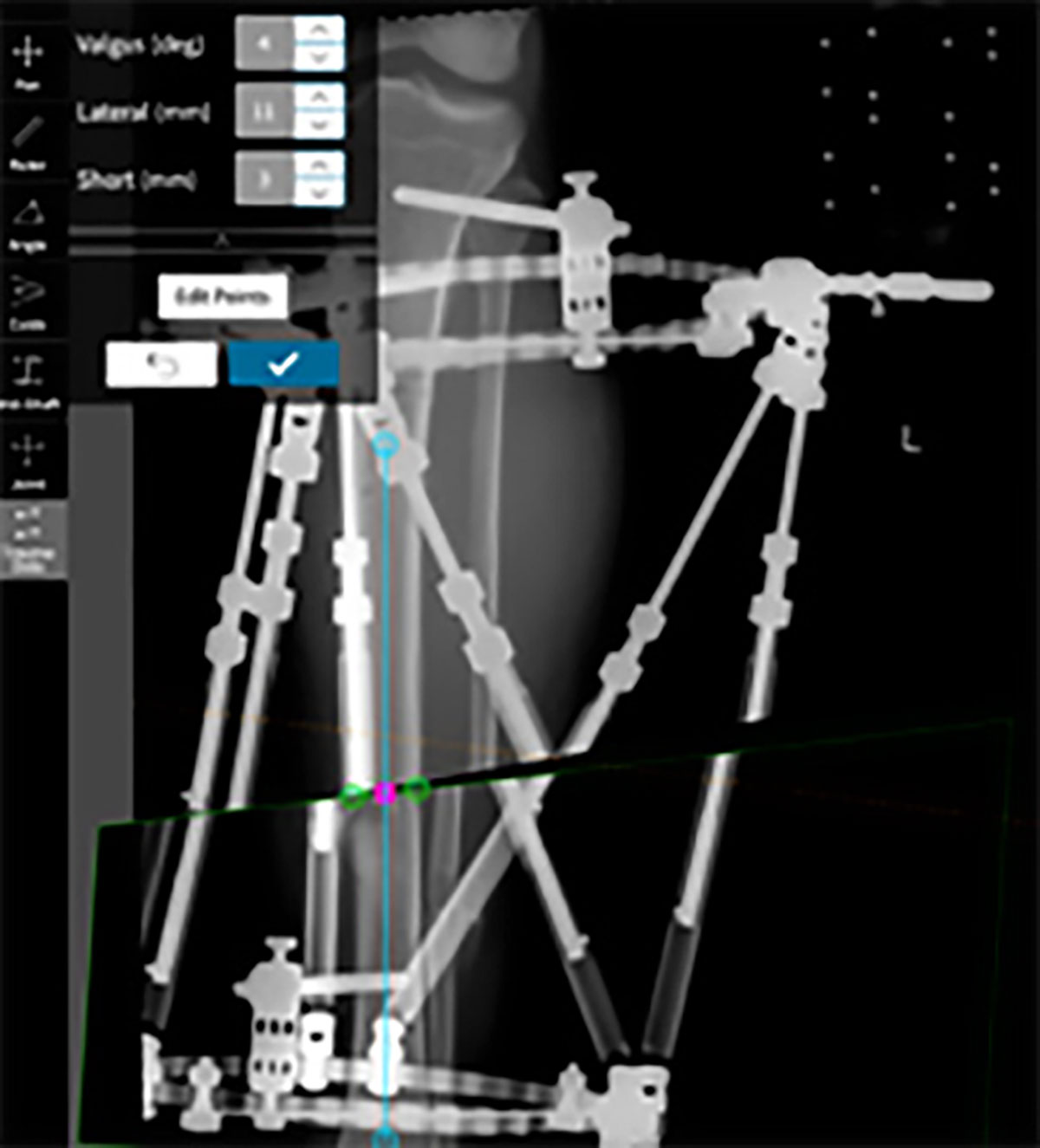 trauma techniques figure 10c