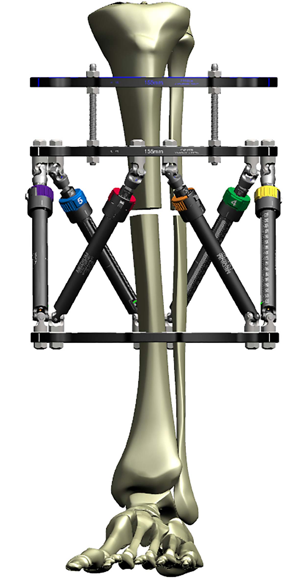 Figure 2a
Construct optimized for rotational correction