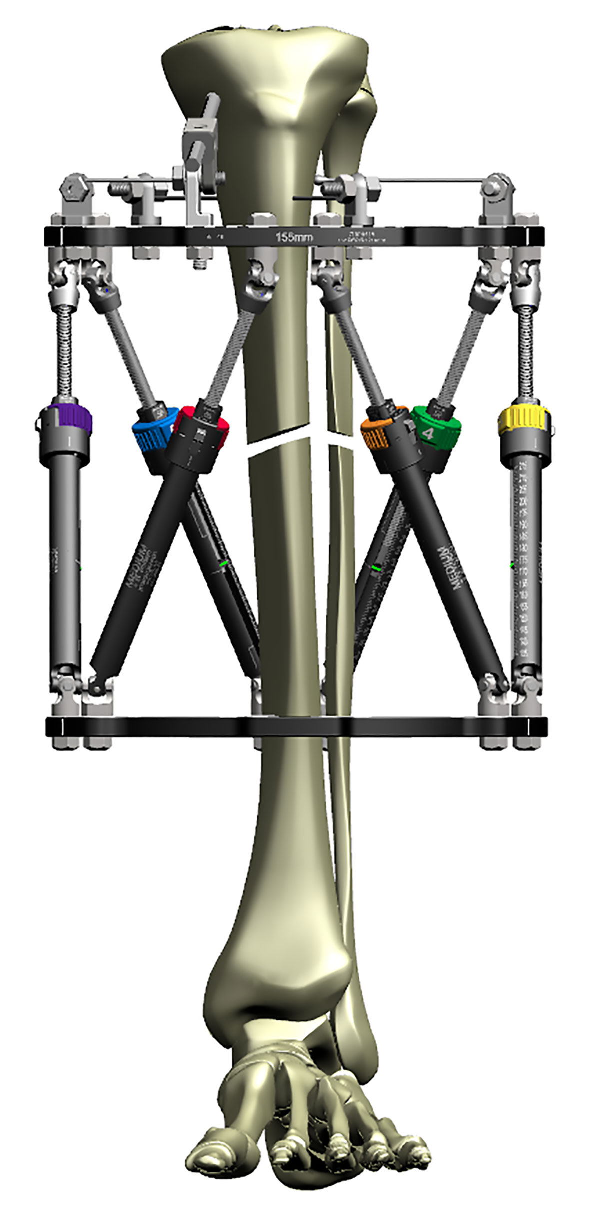 Figure 2b Construct optimized for AXIAL correction