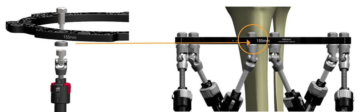 Figure 5b
Dynamization Washer below the Ring – driving axial micromotion