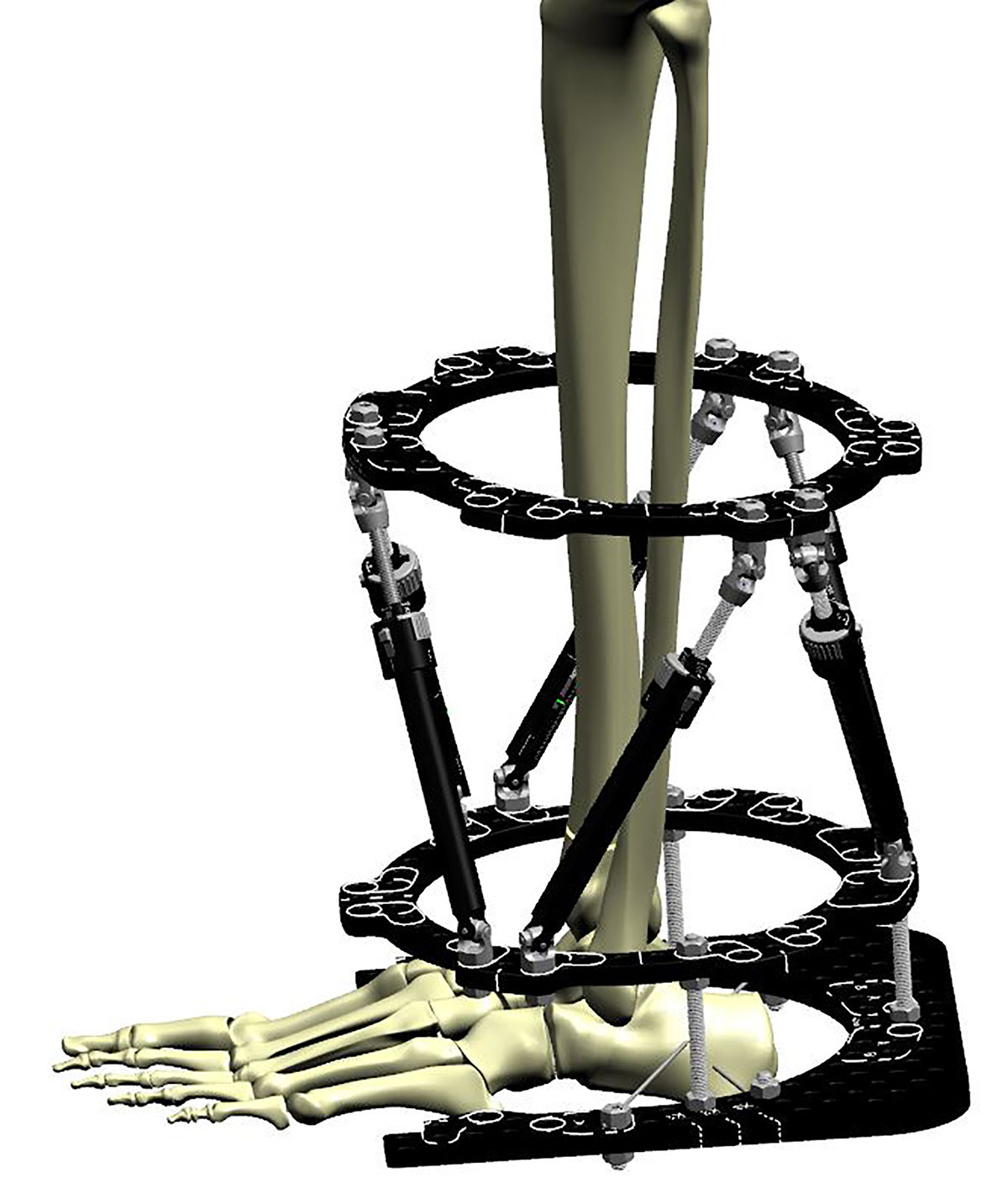 trauma techniques figure 9a