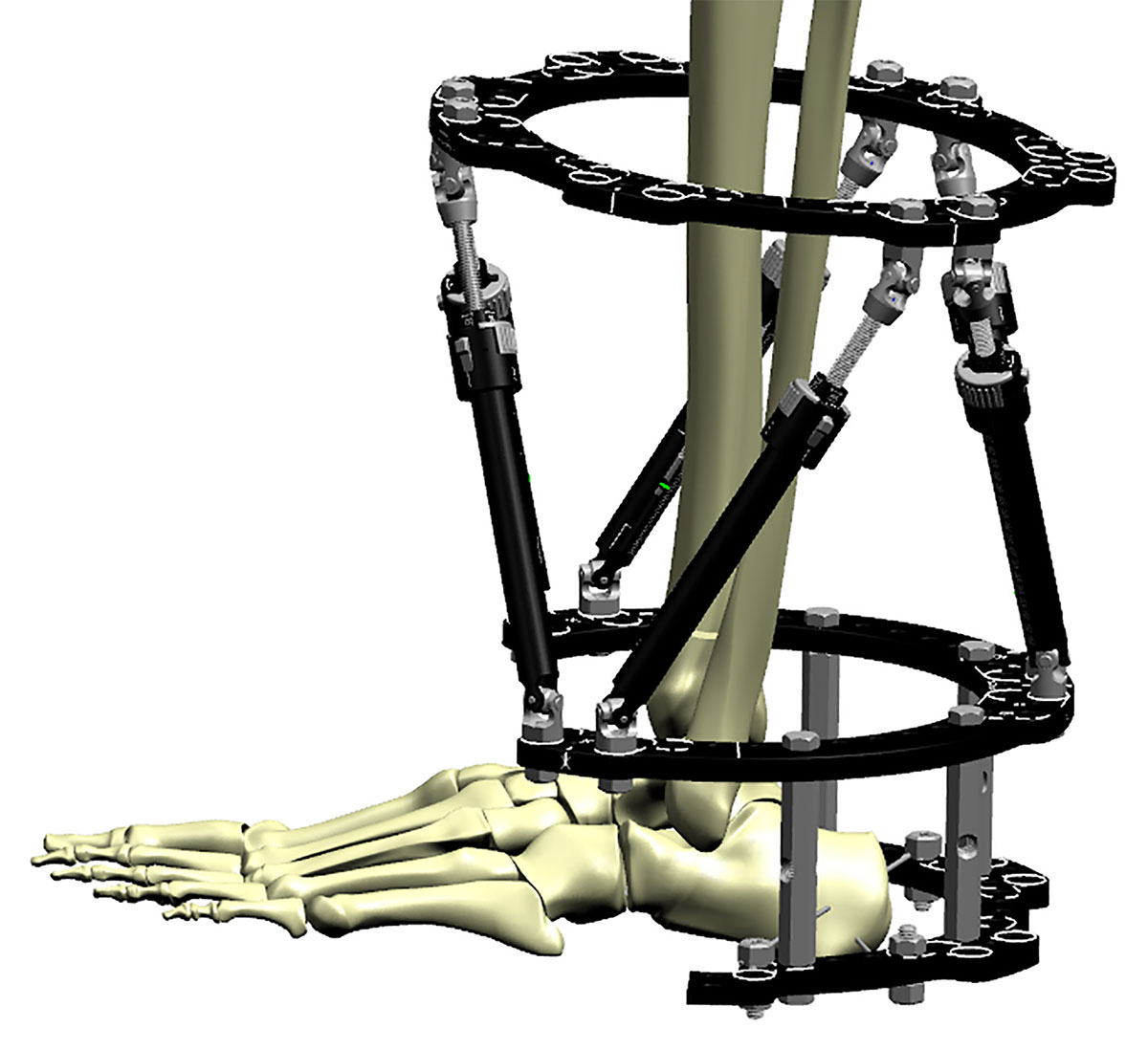 trauma techniques figure 9b