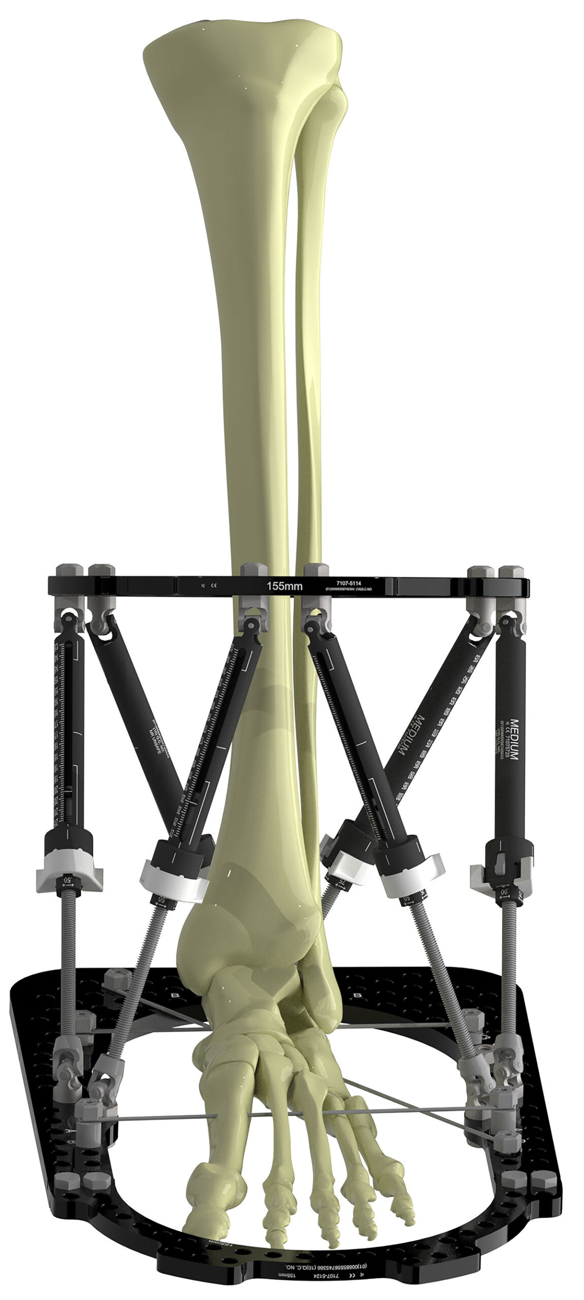 treating equinus figure 3a