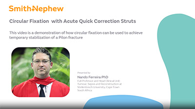 Stabilization of Pilon Using Acute Struts
